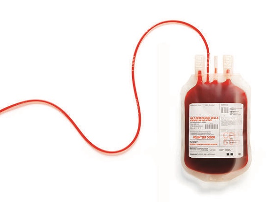 اهدای خون، خوب یا بد؟